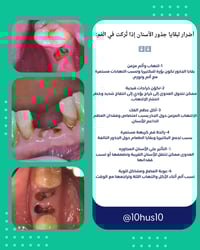 أضرار لبقايا جذور الأسنان 🦷🦷  العلاج مجانا!!!!  للتواصل واتساب 0771291...