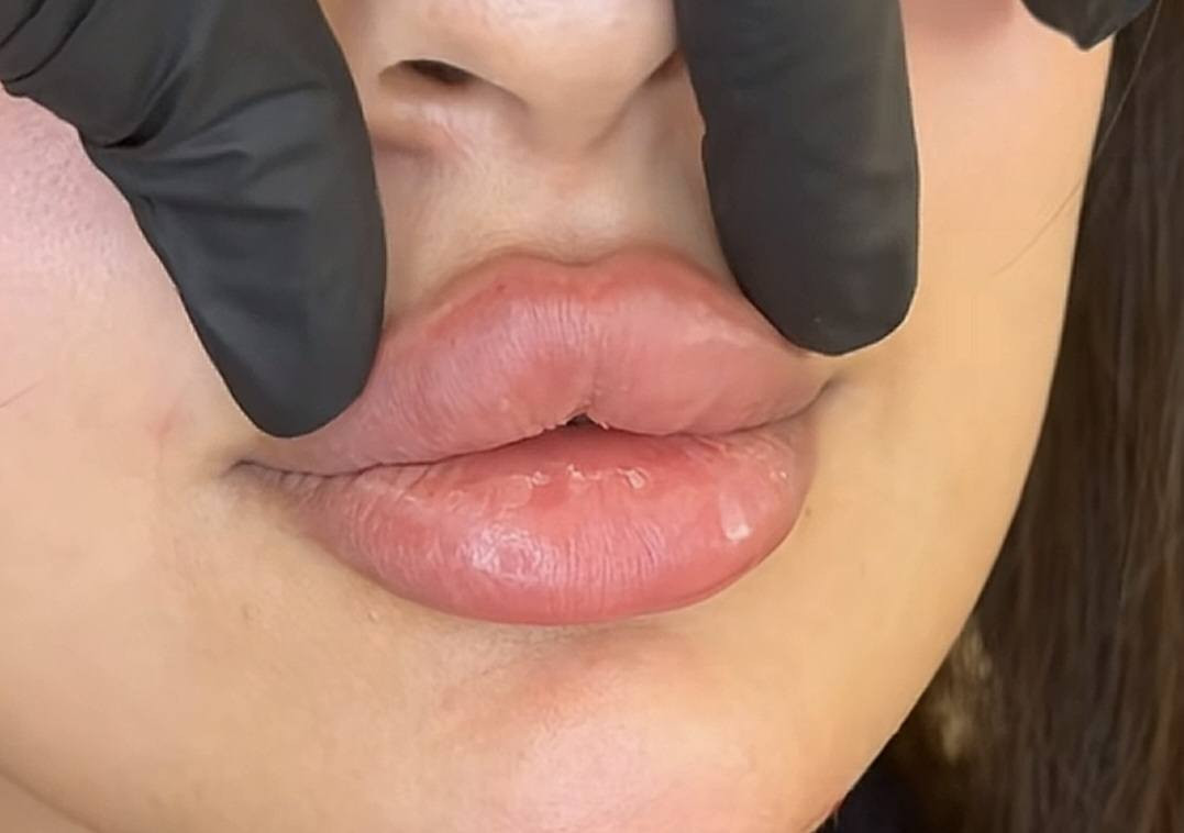 عروضنا مستمره الحد نهاية رمضان المبارك 
للحجز والاستفسار 
ع صفحه الخاصه 
او***********
