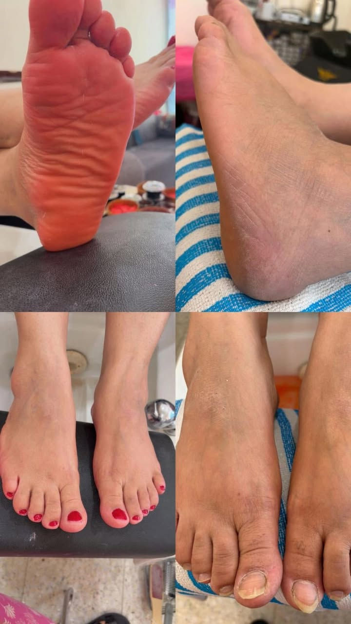 عروض مركزArena Sba
حفافه وجه + شمع + حاجب   بخمسه
سشوار لكل انواع الشعر خمسه
ويفي لكل انواع الشعر خمسه
منكير يشمل سكراب سنفره تنعيم برد اضافر قص لحميه بخمسه
بديكير يشمل تنعيم قدم سكراب سنفره قص اضافر قص لحميه مورد قدم حمام مغربي للقدم بخمسه
واكس شمع يدين كامله بخمسه 
شمع رجلين كامله بخمسه
شمع بطن بخمسه
شمع ضهر كامل  بخمسه
شمع أندر آرم ( ابطين) بخمسه
شمع جسم كااااامل (٢٥ )
تنضيف بشره vip يشمل بخار وهايروفيشيل وداينميك اوكسيجين ازالة الروؤس البيضاء والسوداء ازالة خلايا الجلد الميت بمواد فعاله وقاشطه تجديد وتبييض ونضارة للوجه من خلال العمل بمراحل قناع وسنفره وسكراب وتقشير الشفه وسيرومات عنايه متكامله بأيادي متخصصه للبشره الحساسه والدهنيه والجافه والمختلطه بسعر (15)
معالج شعر كافيار ب(15)
ليفتنك حاجب بعشره
ليفتنك رموش بعشره
صبغ شعر قصير 15 
متوسط20  
طويل30 
قص شعر بعشره
جل اكستينشن ب20 
جلش ب10 
سترونك ب15 
ازالة جلش جل جل اكستينشن بخمسه
ازالة الرموش بخمسه
خلايا جذعيه ب50 
كادر متكامل متواجد طيلة ايام الاسبوع من الساعه العاشره صباحاً الى الساعه 11  مساءا 
العنوان بغداد الغزاليه شارع 15 قرب ماركت الساعه مركز أرينا سبا للحجز والأستفسار ***********
