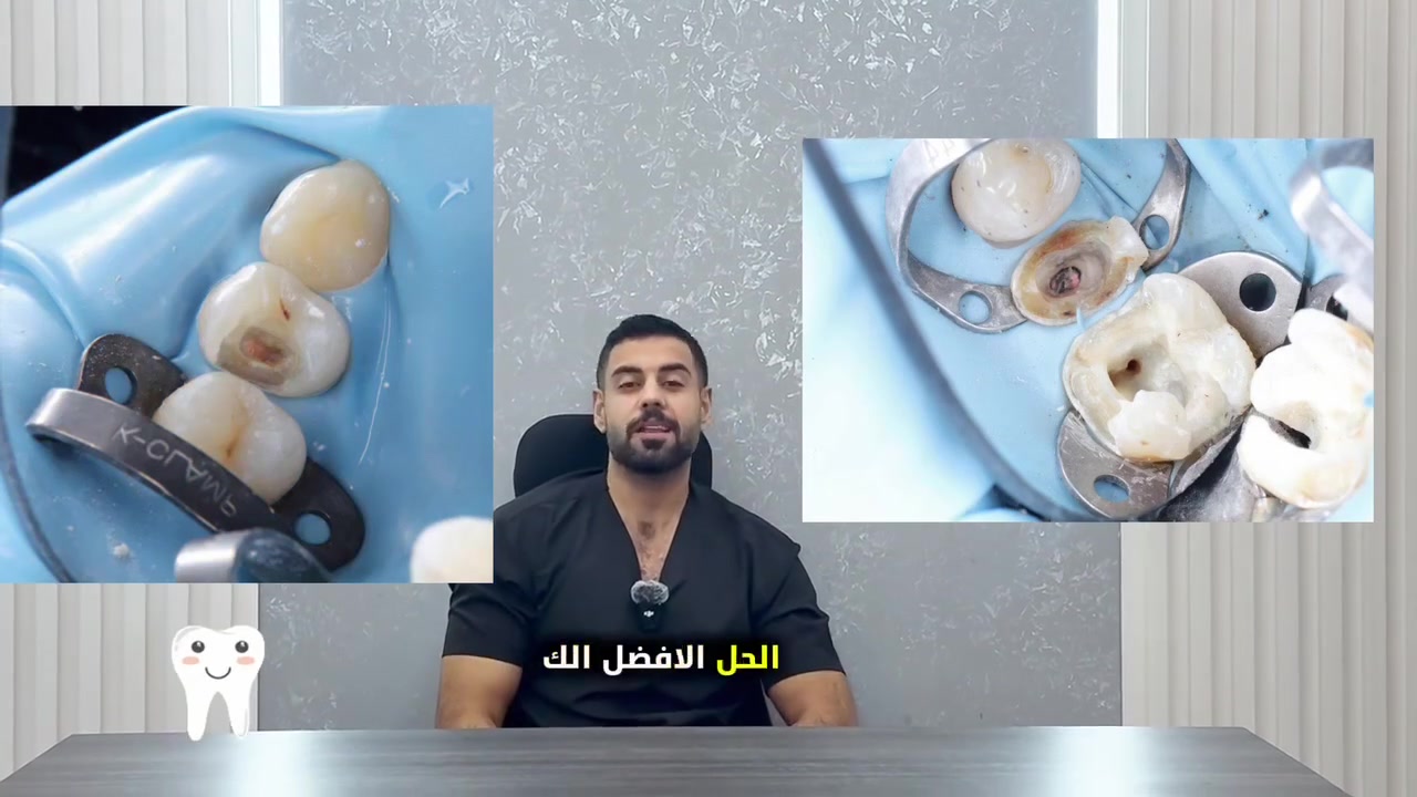 #أهالي_سبع_البور_الطيبين 
الي يريد يسوي أسنانه يم دكاتره #متميزين #وخبرة موجودة عيادة الابتسامة الملكية مركز خاص بالاسنان فقط ،ايضا موجودة دكتورة اسنان للنساء،وأمانة الله شغلهم كلش حلو وراقي جدا ونظافة المكان والترتيب فد شي يليق بالمراجع الله يوفقهم بحق محمد وآل محمد جربوهم وادعولي .

العيادة مفتوحة طيله أيام الأسبوع من الساعة 3-9 مساءآ  
#العنوان|| سبع البور _ شارع الألف_ مجاور شركة القشلة
رقم العيادة للحجز والأستفسار  ***********

صفحتهم على الفيس Royal Smile
