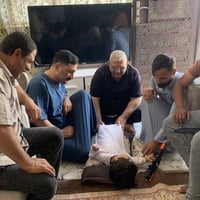 ختان طفل • جهاز حراري • بابل الاسكندرية