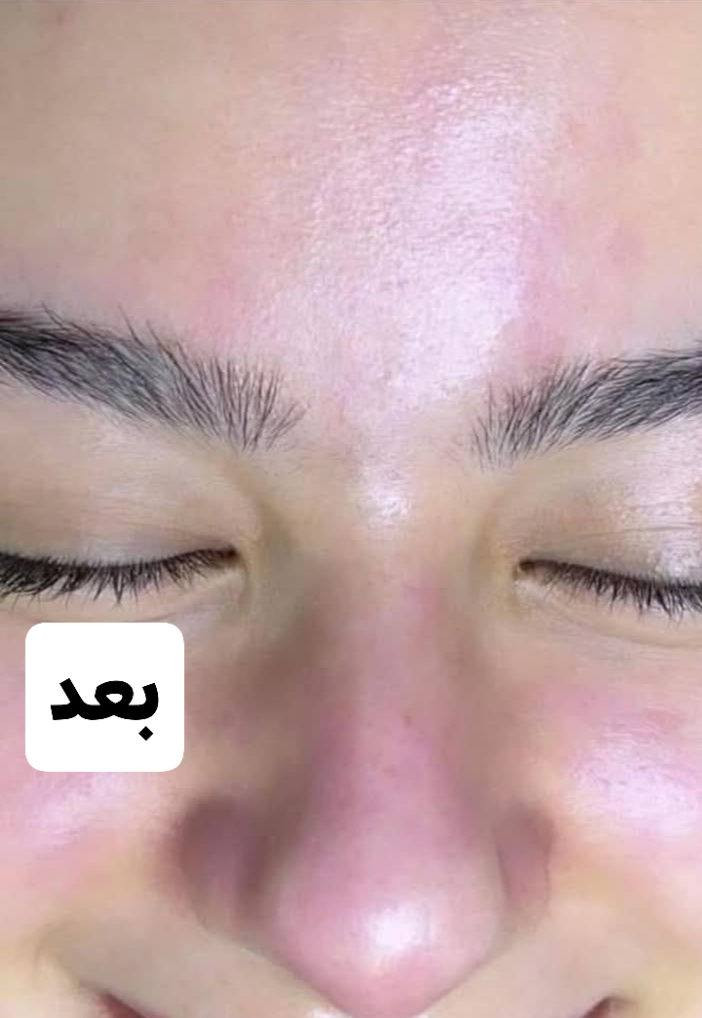 عروض العيد
#عرض_خاص_بأسعار_لاتقبل_المنافسة
#تــاتـوا_بـأحـدث_الأحـبـار_الأمـيـركـيـه_AZ
🔰{ألـ55ـف} تــاتـوا فــايـبـروز
🔰{ألـ55ـف} تــاتـوا مــايـكـروبـلـدنـك
🔰{ألـ45ـف} تــاتـوا 6D
🔰{ألـ35ـف} تــاتـوا بـلــوك
🔰{ألـ35ـف} تــاتـوا تـوريــد شـفــايـف 
🔰{ألـ20ـف} سـحــب لــون  تــاتـوا 
🔰{ألـ20ـف} أزالـة تــاتـوا أطـراف حـاجـب

#قسم_الصالون
🔰️️{ألـ10ـف} قــص شـعـر بأحــدث القــصات 
🔰️️{ألـ5ـف} شســوار شـعـر حســب
🔰️️{ألـ10ـف} معـالـج نانـو للشعـر التالف
🔰️️{ألـ7ف} حــفـافـه وجـه كـامـل مع شمع وسيروم هديه
🔰️️{ألـ15ـف} تركيب رموش طرفيه 
🔰️️{ألـ30ف} تركيب رموش طبيعيه 3D
🔰️️{ألـ30ـف} ميكاب مناسبات فخم مع رموش. مكياج وسط ب20
🔰️️{ألـ30ـف} تسريحات مناسبات. برم اوتسريحه بسيطه ب15

#صـبـغ_الشـعـر_حسب_الطلب
🔰{ألـ15ـف} قصـيـر فــوق الـكــتـف
🔰{ألـ25ـف} قصـيـر حــد الـكــتـف
🔰{ألـ30ـف} قصـيـر تـحــت الـكــتـف
🔰{ألـ35ـف} مـتــوسـط نصـف الظـهـر
🔰{ألـ45ـف} طـويــل نهــايه الظـهـر

#تخصيل_الشـعـر_حسب_الطلب
🔰{ألـ20ـف} قصـيـر فــوق الـكــتـف
🔰{أل35ف} قصـيـر حــد الـكــتـف
🔰{ألـ45ـف} قصـيـر تـحــت الـكــتـف
🔰{ألــ55ف} مـتــوسـط نصـف الظـهـر
🔰{ألـ70ـف} طـويــل نهــايه الظـهـر

#مــسـرح_و_مــعـالـج_و_بروتين_فيرساد
🔰{ألـ40ـف} قصـيـر فــوق الـكــتـف
🔰{ألـ60ـف} قصـيـر حــد الـكــتـف
🔰{ألـ75ـف} قصـيـر تـحــت الـكــتـف
🔰{ألـ100ـف} مـتــوسـط نصـف الظـهـر
🔰{ألـ150ـف} طـويــل نهــايه الظـهـر

#قسم_العنايه_بالبشره
🔰️{ألـ10ـف} خلطه تبيض مناطق حساسه
🔰️{ألـ10ـف} خلطه معالج فوري للكلف
🔰️{ألـ10ـف} خلطه نضاره فائقه للبشره
🔰️{ألـ10ـف} خلطه معالج حب الشباب
🔰️{ألـ10ـف} تـنـظيف بشــره عميق بالماسكات
🔰️️{ألـ10ـف} تـنـظيف بشــره عميق
🔰️️{ألـ20ـف} بي بي كلو عنــايه بالبشــره
🔰️️{ألـ30ـف} ميزوا تبيض فوري للبشره
🔰️️{ألـ30ـف} ميززا معالج فوري للكلف
🔰️️{ألـ30ـف} ميزوا شد و نضاره للبشره
🔰️️{ألـ50ـف} أبرة العروس لنضارة البشره
🔰️️{ألـ5ف}ازاله الشامات السطحيه والزوائد اللحميه

#الـحــجـز_مـســبـق_قـبــل_24_سـاعــه_رجـاءً

🔰نـســتـقـبـل الـزبــائـن الـكــرام
🔰مــن الـســاعـه 🕓  9صـبــاحـاً
🔰الــى الـســاعـه 🕓  12 مـســاءً
عنوان كربلاء حي الوفاء الشارع العام مجاور احمد توفيق للستائر
***********
