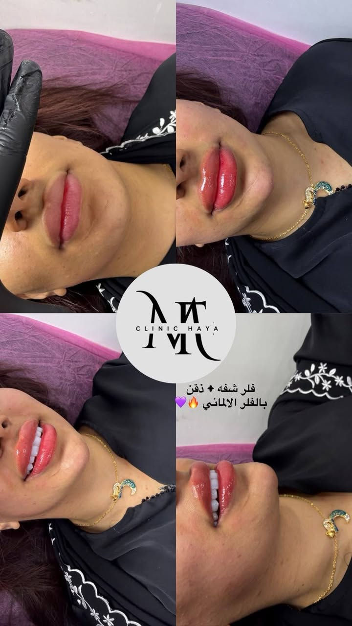 ***********
البياع تقاطع الشرطه الرابعه يم مطعم السديل

