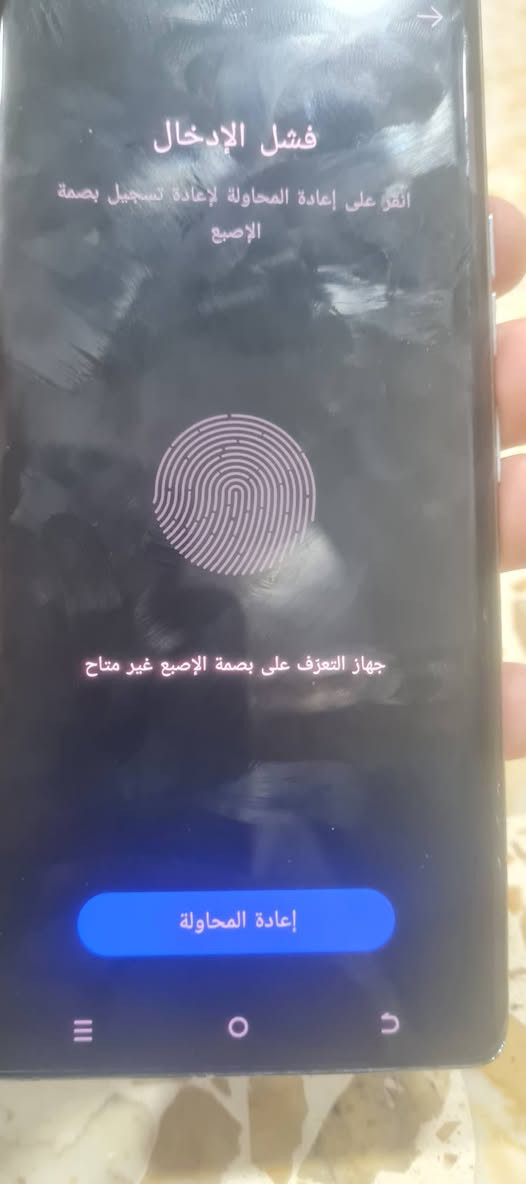 السلام عليكم تكنو كامون 40بر 5G
  ذاكره 256
رام 12+12
فقط بصمه ما تشتغل ول سماعه الداخليه هم ما تشتغل 
اثر وكعه 
سعر 180مجال بصيط مال جيه 

*********** اتصل ودلل
