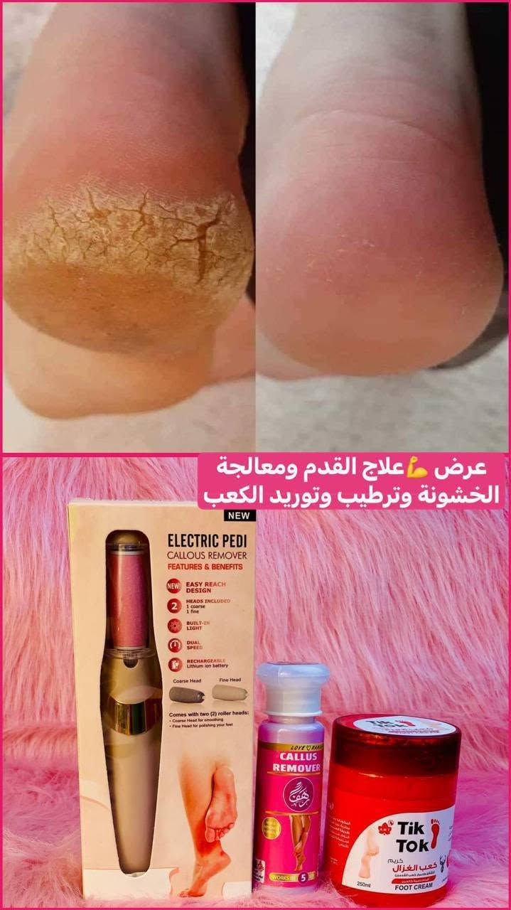 🎀العروض ويانه غيررر🎀 
عرض تقشير وترطيب وتنعيم وتوريد الاقدام 🦶💋
اجمل عرض يخلي الأقدام مثل قدم البيبي يقشر القدم ويزيل التشققات والفطريات وينعم ويرطب ويورد القدم القدم يتكون 👈جل كالوس +جهاز تقشير القدم + كعب الغزال 

🌸جل كالوس القدم من رهف
* جل مزيل الجلد الميت و المناطق المتصلبة للقدم من رهف
* نتائج مضمونة خلال 5 دقائق
* يمنحك بشرة ناعمة وملساء
* تركيبة ثلاثية المفعول
* يخترق الجلد الميت
* يقشر - بدون تهيج
* يجعل - ملمس القدم ناعمة
* علاج للجلد الميت
* يعالج جميع انواع التشققات و المناطق المتصلبة بالقدم

🌸 جهاز تقشير القدمELECTRIC PEDI 
💝 جهاز تقشير القدم  الالكتروني 
💝 يعمل على ازالة الجلد الخشن و الميت من القدمين للحصول على أنعم كعب 💯
💝 سهل الاستعمال لا يأخذ منك وقتا و لا يسبب أي تهيجات 
💝 قابل للشحن فلا يحتاج الى تغيير البطاريات مثل اغلب الاجهزة 👌
💝 مقاوم للماء 💦
💝 مزوّد بسرعتين (قصوى و منخفضة) 
💝 تصميم انسيابي مريح مناسب لليد 
💝 مزود برأسين دوارين ، واحد  للتلميع و الآخر للتنعيم 😍

🌸 كريم كعب الغزال  Tik Tok 
🌸 فوائد كعب الغزال للقدمين 
🌸 تنعيم القدمين.
🌸  ترطيب الكعبين ومنع تشقّقهما.
🌸 إعطاء أسفل القدمين اللون الوردي.
سعر العرض 18 الف 
🚘 يوجد خدمة توصيل لجميع محافضات العراق ٤ الاف 🚘


**إذا كنت صاحب هذا الإعلان وتريد حذفه لأي سبب، رجاءا أرسل رسالة إلى الدعم الفني**