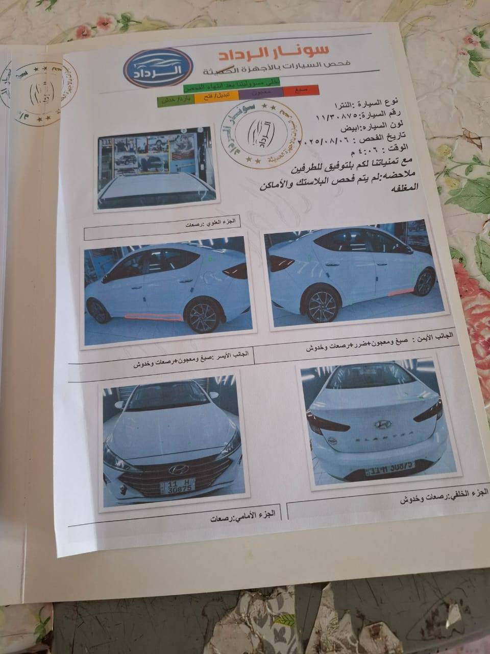 موديل 2019
خليجي فول موصفات
محرك 2.0
السعر 158 وبي مجال بسيط
***********
اني مكلف بنشر هذا رقم صاحب سيارة
