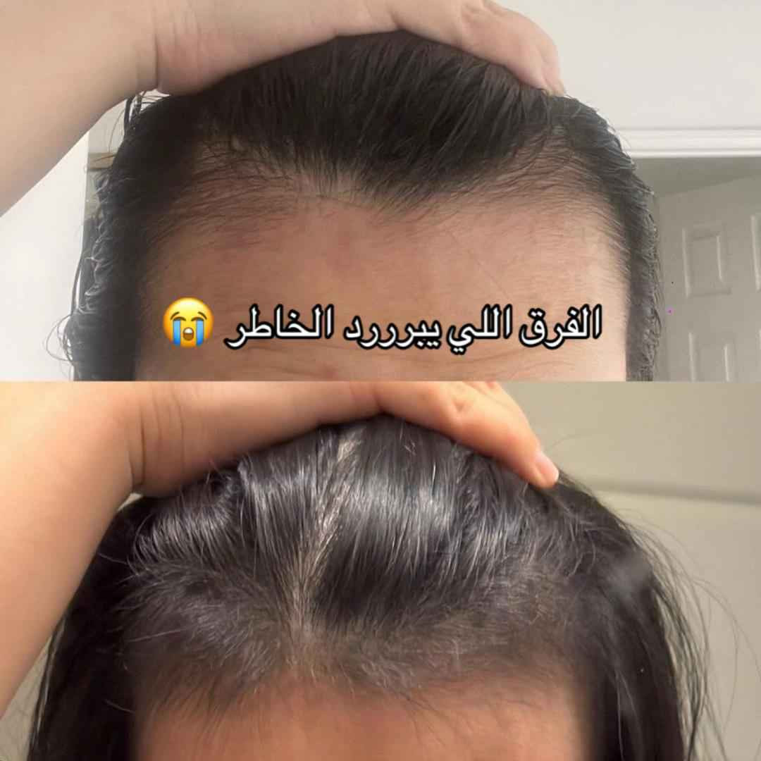 صابونة سيفن جرين (Seven Green Shampoo Bar):
الوصف: قالب شامبو صلب مصنوع من خلاصة الأعشاب الصينية التقليدية مثل Cacumen Biotae وIsatis Indigotica.
الفوائد: تنظيف فروة الرأس بعمق وإزالة الدهون والقشرة، تقوية بصيلات الشعر، والمساعدة في تكثيف الشعر كبديل طبيعي لزراعة الشعر.
المميزات: خالية من الكبريتات والسيليكون والمواد الكيميائية الضارة دهل اوران, واسط


**إذا كنت صاحب هذا الإعلان وتريد حذفه لأي سبب، رجاءا أرسل رسالة إلى الدعم الفني**