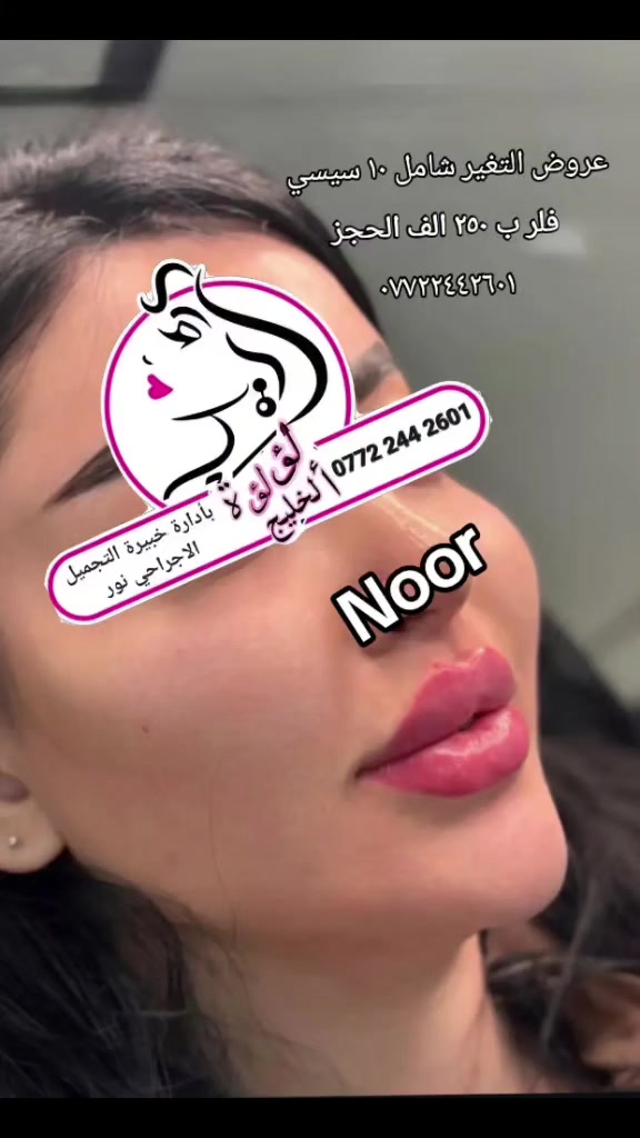 عروض الفلر الكوري التغير شامل ١٠سيسي سيسي فلر ب ٢٥٠ الف
١٥فلر سيسي ٣٥٠ الف 
فلر كوري سيسي شفه ٥٠ الف 
فلرشفه سويسري سيسي ٧٥ الف 
العنوان بغداد الامين الثانية سكينه
 الحجز ***********
