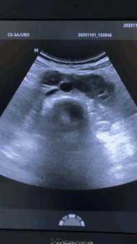 تتواجد يوم الأربعاء القادم ان شاء الله الدكتورة نهى فارس عطااللة الجبوري اخصائية الاشعة التشخيصية دكتوراه بورد عربي زميلة المجلس العربي للاختصاصات الصحية 
سونار ودوبلر ومفراس ورنين 
سونار ودوبلر البطن 
سونار ودوبلر العنق والاوردة والشرابين 
سونار الثدي وسونار الغدد 
سونار الدماغ للأطفال وسونار الخلع الولادي 
سونار ودوبلر العضلات والمفاصل 
سونار الجلد وسونار العين 
يوجد في العيادة اشعة ملونة لفتح الانابيب 
عنوان العيادة القيارة شارع البيكمات مجمع الكوثر الطبي مقابيل روتانا مول 
اوقات دوام العيادة من الساعة الواحدة ضهرا إلى الساعة السابعة مساءا 
يوم السبت ويوم الأربعاء من كل اسبوع 
للحجز والاستفسار الاتصال على رقم العيادة ***********
لايك لصفحة العيادة ومتابعة لطفا 🌹
