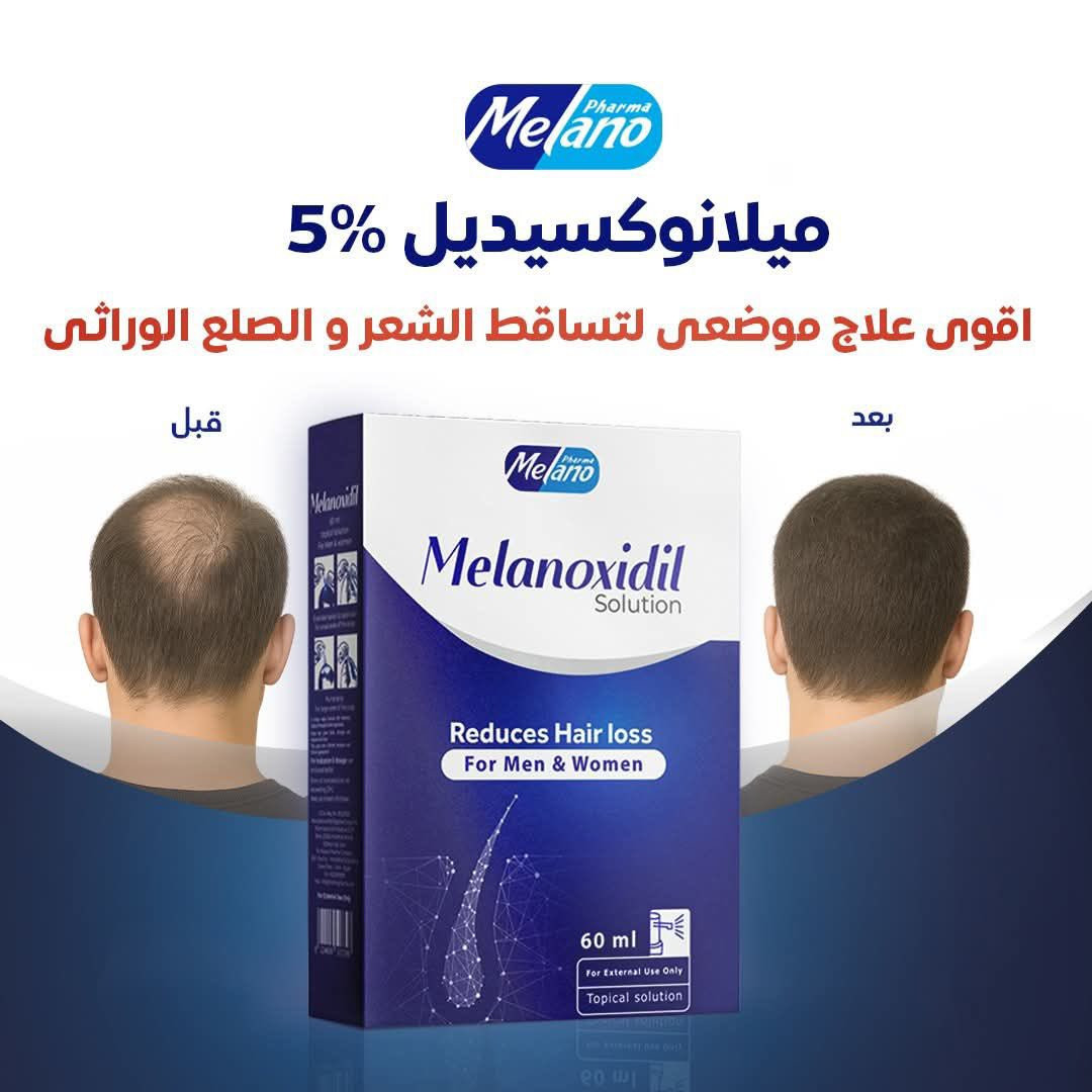 منتجات شركة ميلانو عالية الجودة وفعالية أكيدة من شركة اشرافة بغداد 
للتواصل 
***********
