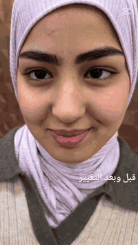 قبل وبعد … التغيير الحقيقي  عيادة هيلدا لطب الأسنان والتجميل العنوان📍ب...