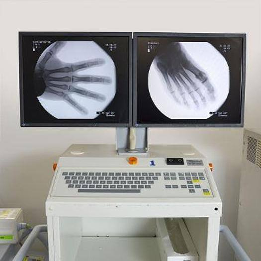 🔥 متوفر للبيع جهاز C-Arm ألماني أصلي
✨ Siemens Siremobil Compact L
✅ دقة تصوير عالية داخل العمليات
✅ مناسب لجراحة العظام والكسور والعمود الفقري
✅ حركة مرنة وسهولة استخدام
✅ شاشة دبل مونيتور
✅ نظام تصوير مباشر Fluoroscopy
✅ بحالة ممتازة وفحص كامل

💥 سعر مناسب جداً ومنافس لفترة محدودة
📍 متوفر تجهيز داخل العراق
📞 للاستفسار والمراسلة خاص أو اتصال مباشر:***********
جهاز عملي واعتمادي للمستشفيات والمراكز الجراحية

