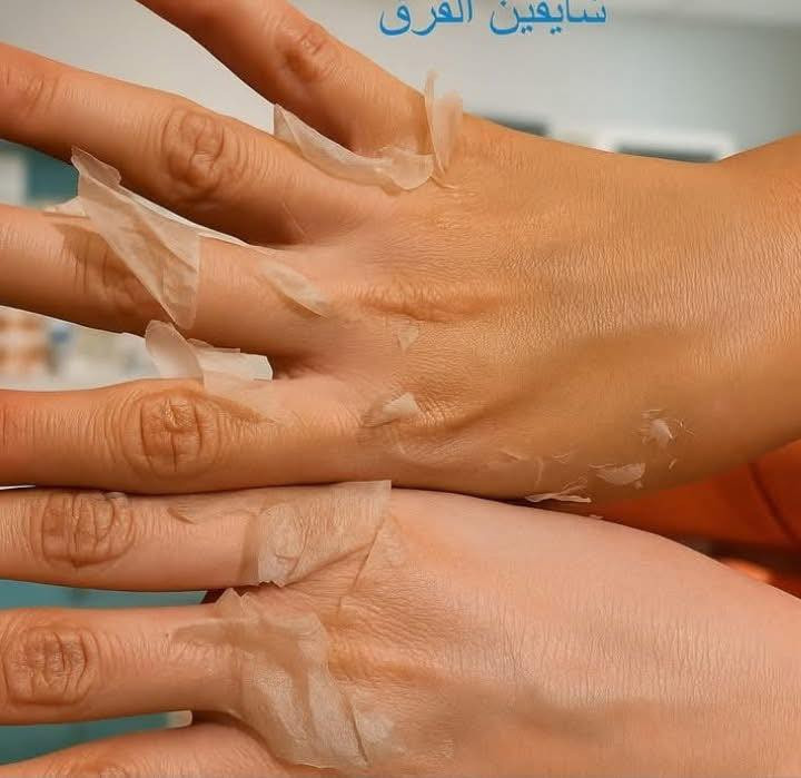 مقشر الأحماض وصل يا حلوين 🌹❤️
نلحق بقا نعمل تقشير عشان ندخل العيد منورين باذن الله 🤫🧡


**إذا كنت صاحب هذا الإعلان وتريد حذفه لأي سبب، رجاءا أرسل رسالة إلى الدعم الفني**