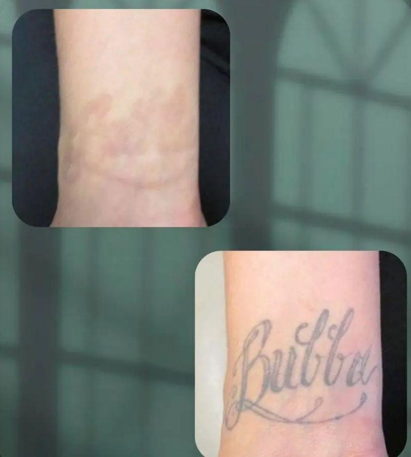 مستعدون لازالة جميع انواع الوشوم القديمة والحديثة بآحدث الأجهزة 
البصرة الجمهورية شارع الاطفاء مقابل ريتاج سنتر قرب حسينية البتول عليها السلام 
*********** البصرة, العراق
