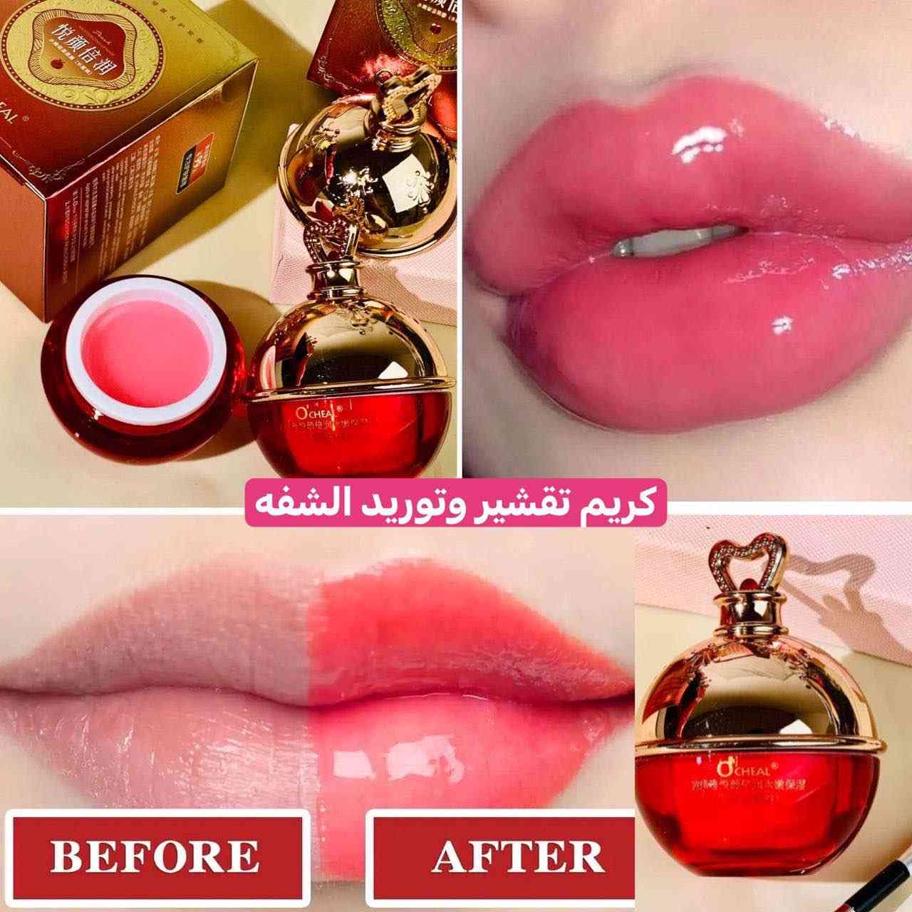 كريم دم التنين الاصلي 💋💋
 
كريم ماسك دم التنين ♥️♥️
مرطب ومورد مغذي شفايف يملئ الخطوط ويغذي الشفاه الجافة ويرطبها 
فوائده. 
🌸يورد الشفه 
🌸يمنع تكسر الشفه
🌸يزيل خطوط الشفه 
🌸يغذي ويرطب الشفة 
🌸يمنع ويعالج التشققات 

‎🌸 مورد ومرطب شفة مخصص لتغذيه الشفتين يرطبها ويعيد حيويتها وتوريدها 

🌸 كريم يمنع التشققات و تكسر الشفه و يخفف الخطوط الخفيفة
‎المرطب غني بفيتامين سي ومضادات الاكسده الي تنطي  تغذيه وعنايه وتعيد لون الشفه الجميل 

🌸 بلاضافه الى فوائد فيتامينات الفواكه المضافة اليه الي حينطي تغذيه مضاعفة و طعم لذيذ
#الاصلي #الكوري

🚘يوجد خدمة توصيل لجميع محافظات العراق ٤ الاف🚘 بغداد, العراق


**إذا كنت صاحب هذا الإعلان وتريد حذفه لأي سبب، رجاءا أرسل رسالة إلى الدعم الفني**