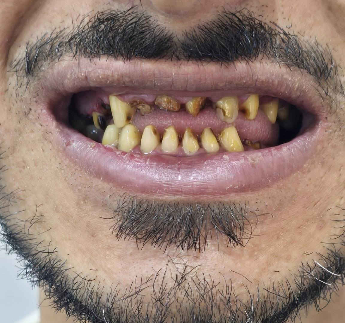 سلام عليكم ورحمة الله وبركاته
اسعد الله اوقاتكم 
وكل #عام_وانتم_بالف_خير
المختبر الابداع السوري  لصناعة الاسنان
و التعويضات السنية وتركيب الأسنان
وبأنسب الاسعار بجميع المحافظات
العراقية 
ملاحظة لدينا كادر يزور المريض للبيت ويتم العمل في المنزل 
للتواصل والحجز. ***********»꧁꧂«***********
