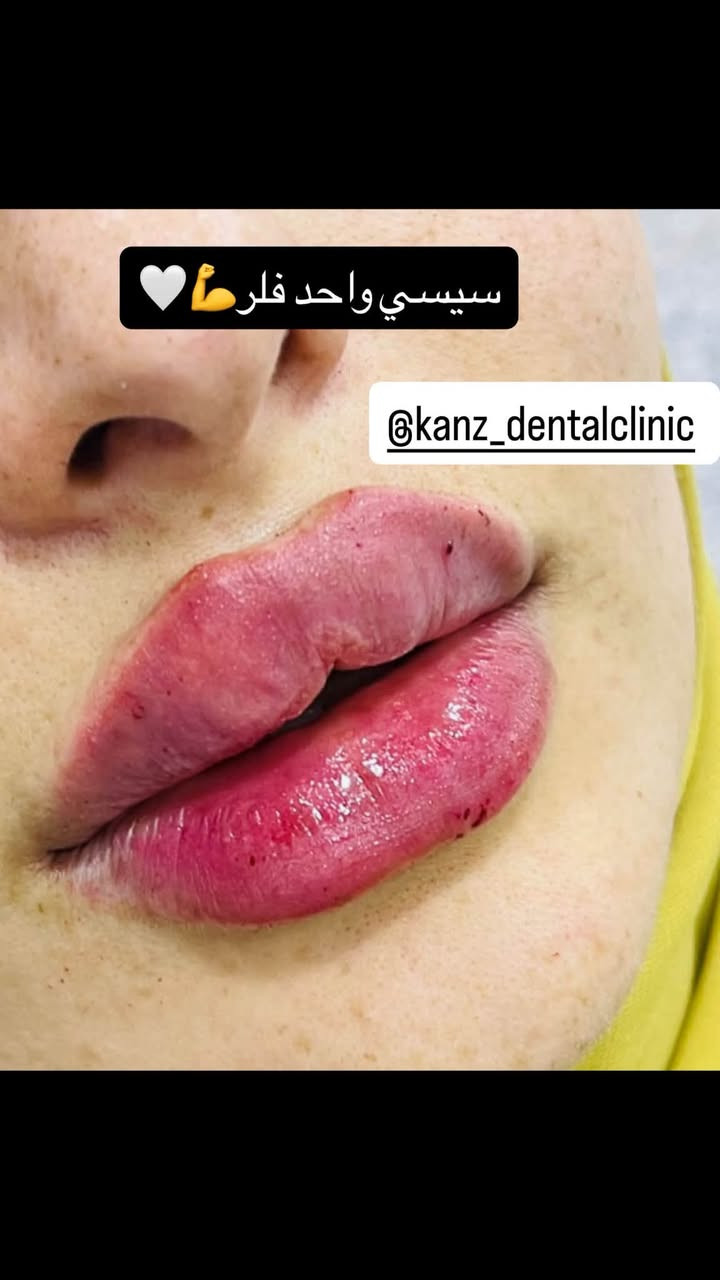 نستقبلكم بكل حب بعياده كنز الابتسامه
نزله گميرةفوق صيدليه ليث صباح  مقابل علوة ابو محمد 
للاستفسار. الاتصال او مراسلة الرقم ***********
