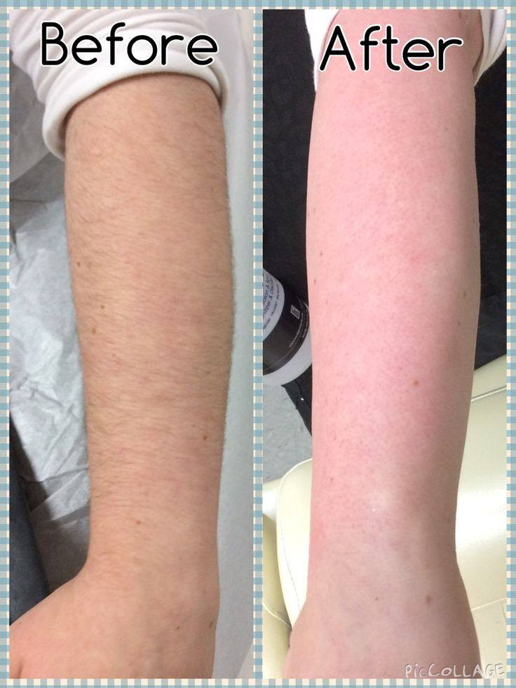 عررررررض النظافه والتبييض..😍😍
وفرنالكم #البودره_الروسيه لازاله الشعر بكل سهوله من كل مناطق الجسم
وايضا #غسول_الطين_البركاني الي راح ينعش الجسم برائحته العطره المميزه والي راح يبيض ويفتح كل المناطق بالاستمرار..
العرض فقطططط ب 15 

وتوصيل مجاني


**إذا كنت صاحب هذا الإعلان وتريد حذفه لأي سبب، رجاءا أرسل رسالة إلى الدعم الفني**