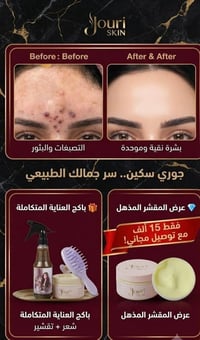 منتجات ايرانية للشعر • علاج تساقط الشعر • انبات فراغات الشعر • مقشر Go...