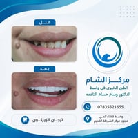 تيجان زيركون • مركز الشام الطبي • واسط قضاء الحي