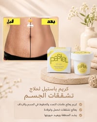 كريم تشققات • كريم علامات التمدد • تشققات الحمل • مرطب بشرة • كريم باس...