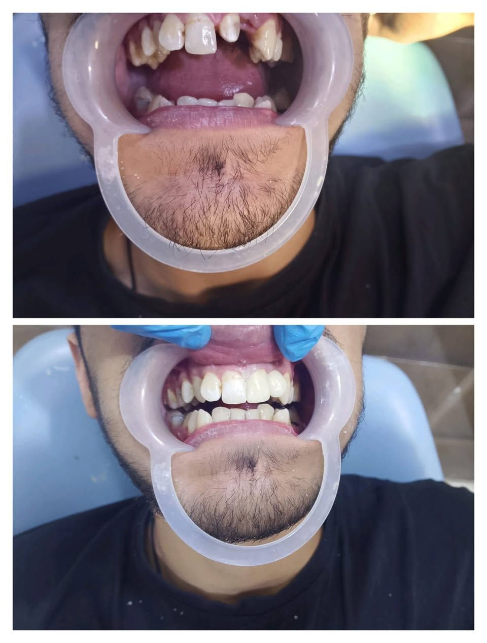 تعلن عيادات إبرو لطب الاسنان وتجميل عن عروض وتخفيضات مكان العياده ماجديه نهاية شارع الجامع مقابيل مأكولات البيك ***********
