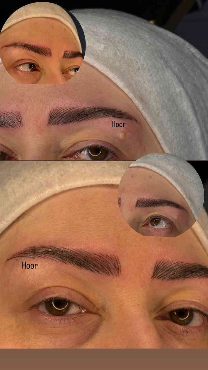 العنوان....الفرع الاول /الاعضميه سبع ابكار قرب منتزه الهبي دي مجاور اسواق الروان
الفرع الثاني/الدولعي شارع بيوت فنجان مقابيل مؤسسه فنجان الحكوميه للأستفسار والحجر الاتصال ع هذا الرقم 👈🏻***********
