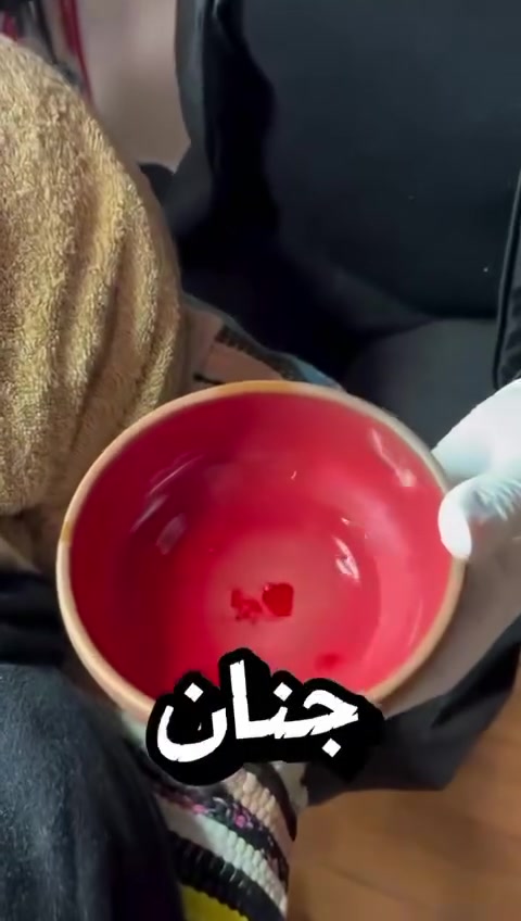 جلسه التقشير الفوري متاحه الآن ب خصم 50٪


**إذا كنت صاحب هذا الإعلان وتريد حذفه لأي سبب، رجاءا أرسل رسالة إلى الدعم الفني**