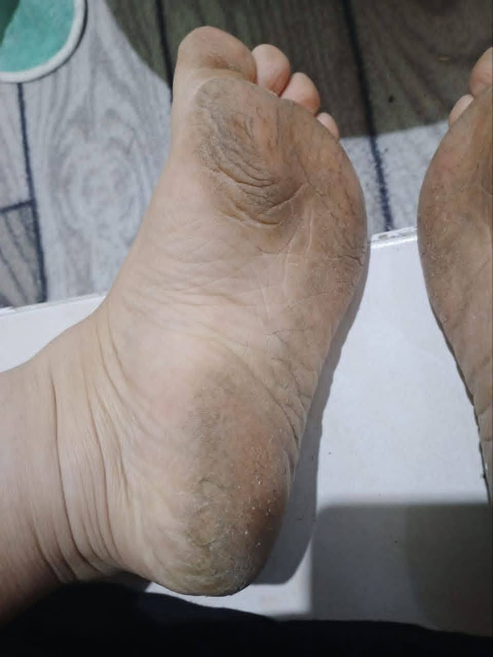 التوصيل متوفر لجميع محافظات العراق 🚗 
بكج العناية بالاقدام المتكامل النتائج الباقية بالتعليقات بصفحتنا 👇


**إذا كنت صاحب هذا الإعلان وتريد حذفه لأي سبب، رجاءا أرسل رسالة إلى الدعم الفني**