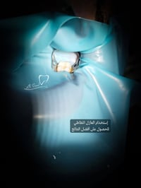 مجانا • حشوات ضوئية • جامعة بابل