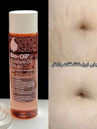 زيت بايو اويل • مشاكل البشرة • المحمودية بابل