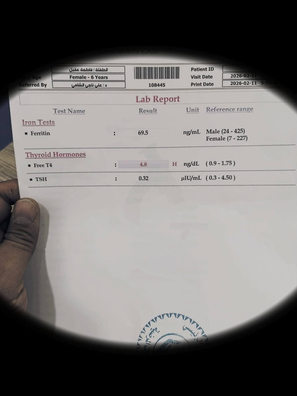 بفضل الله تم تشخيص مرض ارتفاع نسبة هورمون الغده الدرقية لطفلة تبلغ من العمر  6 سنوات 

و طبعا كالعادة تشخيص وهمي و خاطيء  على مدى 6 سنوات  و الضحيه هيه الطفلة ، وزنهه و طولهه اقل من الطبيعي بنسبة كبيرة  بالإضافة الى المضاعفات الاخرى على النشاط الحيوي و الدماغي للطفلة 

و الملفت للنظر ، علاج methimazole  الخاص بهذا المرض غير متوفر في صيدليات الرفاعي ، يعني لم يتم 
تشخيص هذا المرض سابقا لاي مريض !!!

أطفالكم أمانة في اعناقنا 
حفظكم الله جميعا 
عيادة الدكتور علي ناجي الشامي/ اختصاص طب الأطفال و الخدج و حديثي الولادة  
الوحيد الحاصل على شهادة الدكتوراه في طب الاطفال في قضاء الرفاعي

الرفاعي/ شارع الأطباء 
***********
***********
