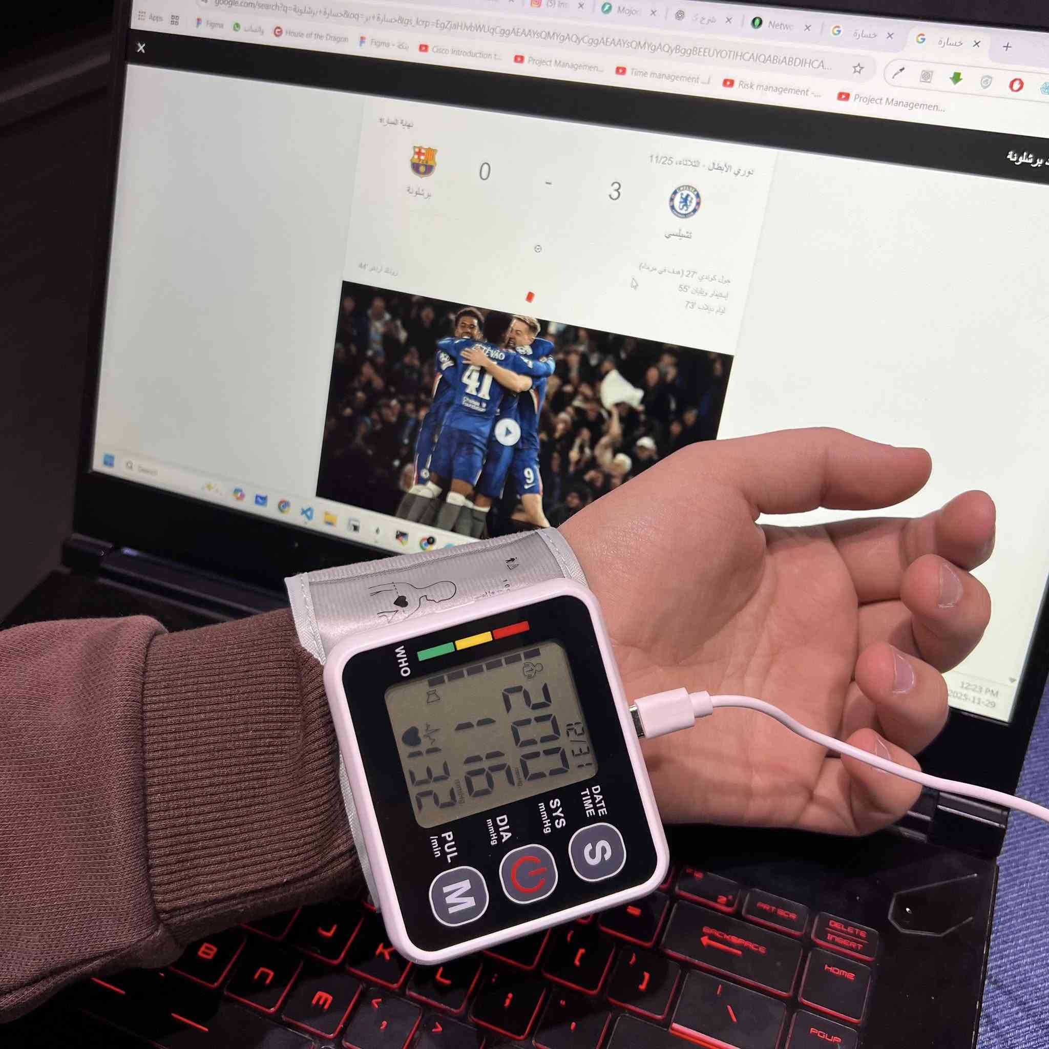 جهاز قياس ضغط الدم الإلكتروني للرسغ الناطق باللغة العربية منتج صغير الحجم ومحمول مصمم لتوفير قراءات سريعة ودقيقة لضغط الدم ومعدل النبض في أي وقت ومكان. إنه يتميز بتصميم سهل الاستخدام بزر واحد، مما يجعله مناسبًا لجميع الأعمار.
سهولة الاستخدام: يعمل الجهاز بضغطة زر واحدة (تشغيل/إيقاف) لتبدأ عملية القياس تلقائيًا بالكامل.يعمل بالكهرباء وبالبطاريات .

شاشة LCD كبيرة: يحتوي على شاشة رقمية واضحة ومضاءة خلفيًا لعرض النتائج بأرقام كبيرة، مما يسهل قراءتها حتى في ظروف الإضاءة المنخفضة.

قابلية النقل: بفضل حجمه الصغير ووزنه الخفيف، يمكن حمله بسهولة في حقيبة 

التخزين المرفقة، مما يجعله مثاليًا للاستخدام في المنزل أو أثناء السفر.

تخزين البيانات: يدعم الجهاز وظيفة الذاكرة لتخزين قراءات متعددة، مما يساعد في تتبع اتجاهات ضغط الدم بمرور الوقت.

كشف عدم انتظام ضربات القلب: يتضمن مؤشرًا ينبهك في حالة اكتشاف عدم انتظام في ضربات القلب أثناء القياس.

حافظ على الكفة في مستوى القلب 

ادعم ظهرك وذراعك 

حافظ على قدميك مسطحتين وساقيك مسترخيتين 

الشاشة: شاشة رقمية 

مصدر الطاقة: بطارية AAA DC3V.

نطاق قياس الضغط: 70-106 كيلو باسكال. 

الدقة: الضغط والنبض +/- 3% 

الأبعاد: الطول 78 × العرض 75 × الارتفاع 68 ملم 

نطاق قياس الضغط: الضغط: 0-299 ملم زئبقي، النبض: 40-180 نبضة/دقيقة

هذا الجهاز هو رفيق صحي ممتاز لمراقبة مؤشراتك الحيوية بسهولة ودقة.

السعر 15ألف


**إذا كنت صاحب هذا الإعلان وتريد حذفه لأي سبب، رجاءا أرسل رسالة إلى الدعم الفني**