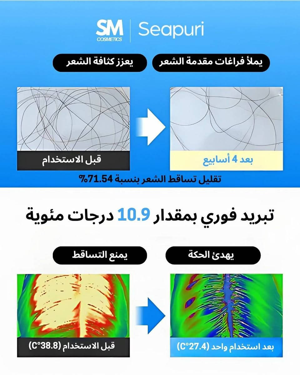 سيروم Seapuri Scalpy للشعر، وهو منتج مصمم للعناية بفروة الرأس وتحفيز نمو الشعر.
يساعد في تقليل تساقط الشعر وتعزيز نمو شعر جديد. 

يحتوي على مكونات مثل الكافيين وحمض الساليسيليك والمنثول لتهدئة فروة الرأس وتنظيف المسام. 

يأتي مع رأس أداة توزيع على شكل كرة دوارة لتعزيز الامتصاص وتنشيط الدورة الدموية في فروة الرأس. 

يوفر ترطيبًا عميقًا ويحافظ على توازن فروة الرأس الطبيعي. 

الحجم: 20 مل.


**إذا كنت صاحب هذا الإعلان وتريد حذفه لأي سبب، رجاءا أرسل رسالة إلى الدعم الفني**