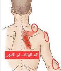 حجامة الابهر • أبو غريب • كادر نسائي