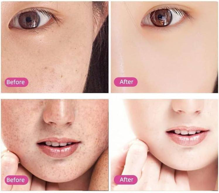 افتحي مشروعاج $ من لبيت وبسعر مناسب وبدون خبرا • 🤩 قلم إزالة الشامة بالبلازما ✨ يخلّصچ من الشامات بلمح البصر 💨 وبسهولة بلا ألم! 🖋️💖" اطلبيه هسه
بسعر مناسب جدا 🔥


**إذا كنت صاحب هذا الإعلان وتريد حذفه لأي سبب، رجاءا أرسل رسالة إلى الدعم الفني**