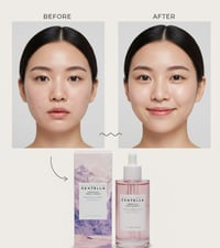 أمبولة سنتيلا • تفتيح البشرة • بشرة زجاجية