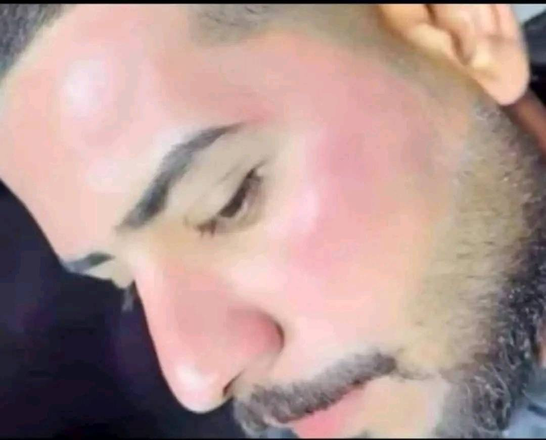 خلطه اسوي الوجه كيمر والخدود ورديه وعن تجارب زباين وكل لجربهة رجع طلب منهة خلطه اصليه وشغل ايدي يعني مابيهة لا عصارات ولا اي مواد كيمياءيه خلطه فقط فيتامينات  تنفخ الوجه وتشد البشرة وتعالج كلف ونمش وحب الشباب وبعد حته متحتاجين تحطين مكياج الخلطه تنفع الشباب ايضا هاي لخلطه معالج كامل للبشرة ونتاءجه داءميه وتبين خلال يومين من لاستخدام  للحجز تواصل خاص الصفحه


**إذا كنت صاحب هذا الإعلان وتريد حذفه لأي سبب، رجاءا أرسل رسالة إلى الدعم الفني**