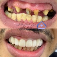تجميل الأسنان • تقويم الأسنان • قضاء النصر