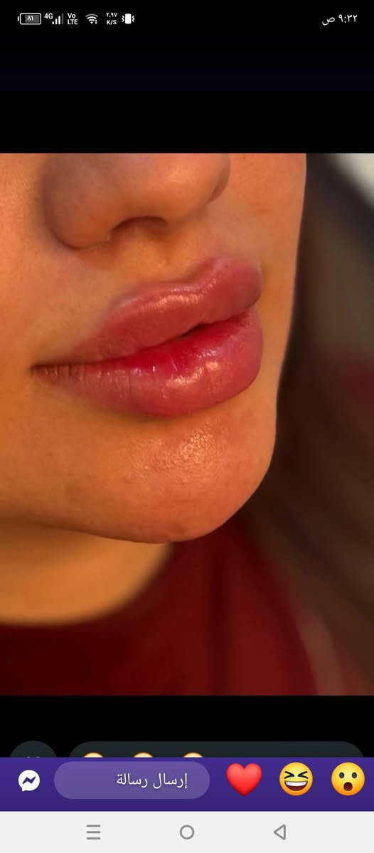 لأنكِ جميلة... خلي جمالكِ يكتمل معنا! 🌸
​جددي إطلالتكِ اليوم في [الجمال بيوتي] ✨
(شعر - مكياج - أظافر - عناية بالبشرة_حقن _تاتو )اسعارنا تنافسيه
الموقع الهارونيه شارع العام مقابل عماره ابو اركان في روضه البشائر(***********)
