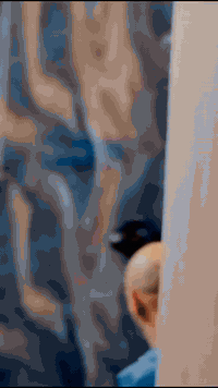 زراعة شعر • تقنية السفير • ضمان مدى الحياة