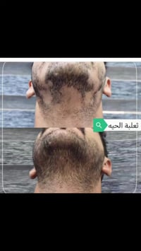 للطلب والاستفسار التواصل على الواتس اب 07759318222