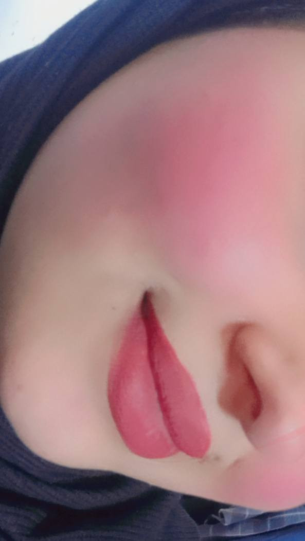 بنات هاي الخلطةدمار تخلي وجهج كزازة يوج وج شاهد الله عليه وبيه ضمان فلوسج ترجعلج بس  والقران تصفي وجهج وتبيضه مابيه خسارة تعاني من كلف عنيد وما لقيتِ حل؟
خلطة فوريفر للوجه تساعد على:
✔ تفتيح التصبغات
✔ توحيد لون البشرة
✔ ترطيب وتغذية عميقة
✔ إشراقة طبيعية بدون إرهاق البشرة

منتجات طبيعية…
نتائج تُلاحظ مع الصبر والاستمرار ✨

الخلطله الملكيه💫


**إذا كنت صاحب هذا الإعلان وتريد حذفه لأي سبب، رجاءا أرسل رسالة إلى الدعم الفني**