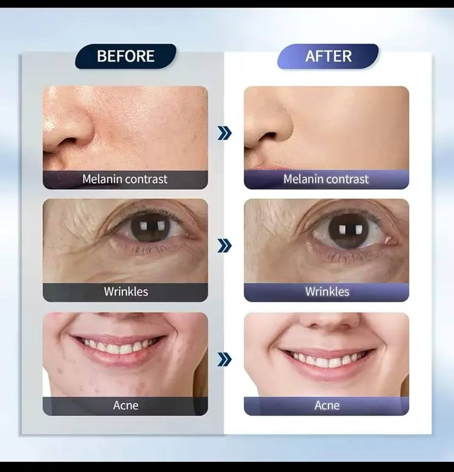 جهاز تجميل مال وجه  شاشة لمس بي هواي شغلات كل نوعية اشعة uv تعالج شي معين


**إذا كنت صاحب هذا الإعلان وتريد حذفه لأي سبب، رجاءا أرسل رسالة إلى الدعم الفني**