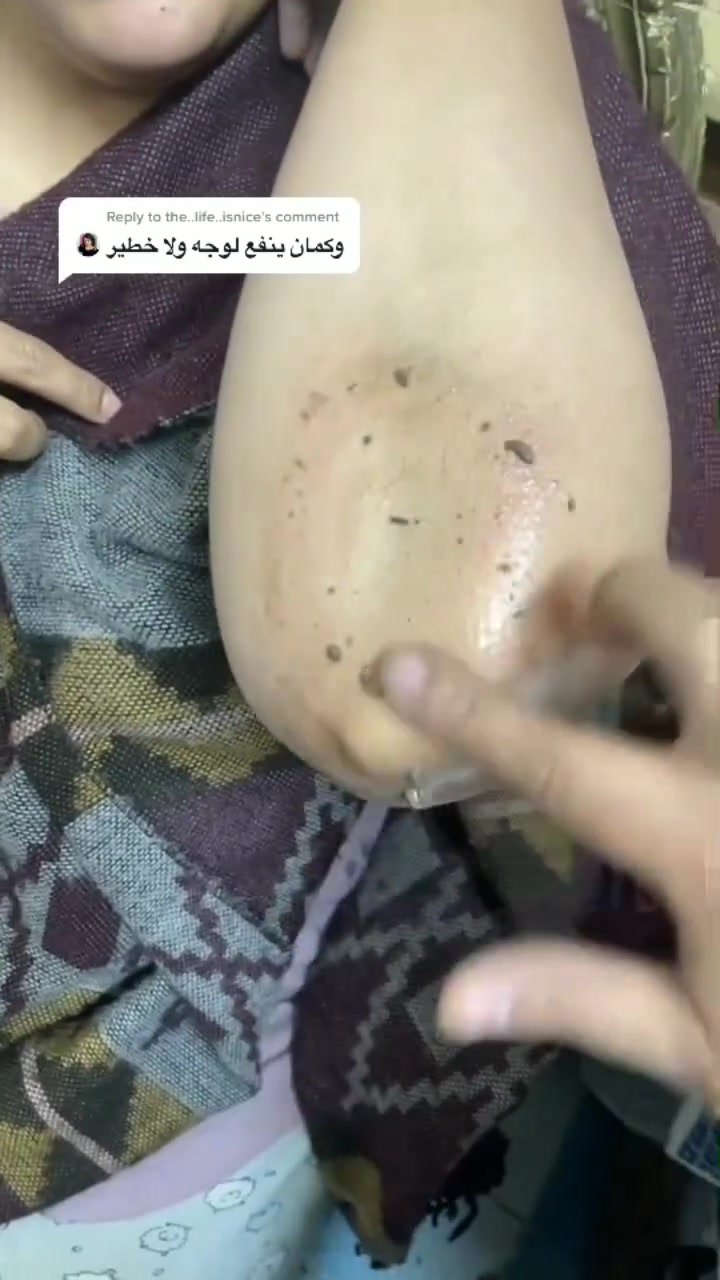 اتوفر لكثرة الطلب 
بخاخ مقشر الاقدام 🇰🇷🇰🇷
مقشر قدم كوري بخاخ 🦋

بخاخ تقشير القدم الفوري
ازالة الكوع الداكن | الركبة | 

فقط رشها على قدميك وتركيها  لمدة دقيقة ثم  قومي بالفرك او تدليك  ثم بعد الاتنهاء تشطف .

نتيجة فورية استخدمها في اي مكان يوصي باستخدامه  2 الى 3 مرات اسبوعيا

السعر / خاص 
تتوفر خدمة توصيل لجميع المحافظات


**إذا كنت صاحب هذا الإعلان وتريد حذفه لأي سبب، رجاءا أرسل رسالة إلى الدعم الفني**