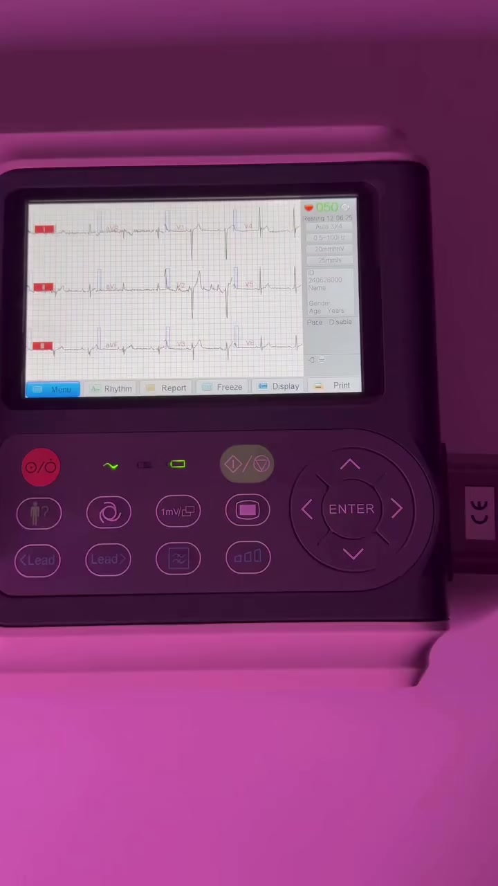 جهاز تخطيط القلب Biocare iE300

الدقّة التي تحتاجها عيادتك… بالحجم المثالي 👌
إذا كنت تبحث عن أداء موثوق وسهولة استخدام في جهاز واحد،
فـ Biocare iE300 هو الخيار الأمثل لك.
المميزات:
✔️ تخطيط قلب 12 Lead بدقّة عالية
✔️ عرض 3 قنوات لتشخيص أوضح
✔️ شاشة ملونة 5 إنچ
✔️ طابعة حرارية مدمجة لطباعة فورية
✔️ سعة تخزين كبيرة للبيانات
✔️ يعمل ببطارية داخلية قابلة للشحن
✔️ تنبيهات ذكية عند فصل الأقطاب أو نقص الورق
✔️ تصميم عملي وسهل الاستخدام داخل العيادات
🔹 مناسب للعيادات، الطوارئ، والمراكز الطبية
🔹 أداء ثابت ونتائج دقيقة يمكنك الاعتماد عليها

📩 للاستفسار والحجز تواصل معنا الآن :
*********** م علياء / إدارة المبيعات
