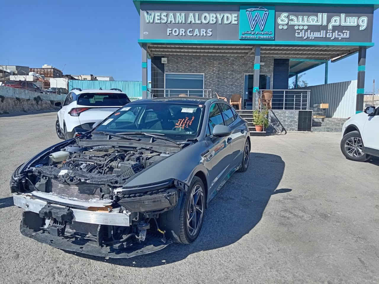 سلام عليكم🌹🌹🌹.                        نوع السيارة /هونداي سوناتا.🌹🌹❤️.                    الموديل/ 2024🌹🌹🌹.             المواصفات بنوراما / فول🌹.                                                                               السيارة موجودة في المنطقة الحرة الاردن.                                                                السيارة تدخل على كتاب شهداء  او كمرك.                                          رقم الهاتف / ***********/ اتصال او واتساب.                       .                                 🌹🌹🌹❤️❤️🌹🌹❤️❤️🌹🌹❤️❤️🌹🌹
