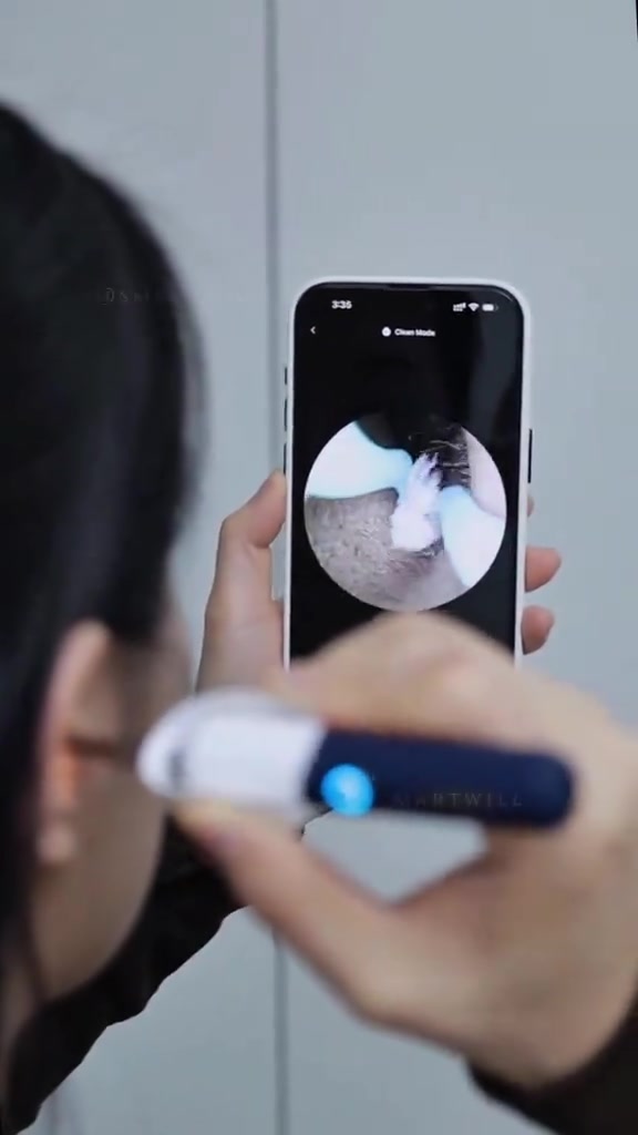هل تعاني من تراكم شمع الأذن أو صعوبة تنظيفها؟ مع جهاز Bebird الذكي لتنظيف الأذن بالكاميرا 👇 📸 رؤية مباشرة على الموبايل ✔️ كاميرا HD تنقل الصورة مباشرة ✔️ تراقب كل خطوة أثناء التنظيف ✔️ دقة عالية توضح أدق التفاصيل 🛠️ رؤوس متعددة لكل حالة 🔹 ملقط لإزالة الشمع الصعب 🔹 ملعقة للتنظيف اليومي 🔹 رأس إسفنجي للشمع الرطب 🔹 أدوات إضافية للعناية الشاملة 💡 تقنية متطورة لراحة أكبر ✨ إضاءة LED قوية ✨ عدسات متعددة لصور أوضح ✨ مقاوم للماء والغبار ✨ تصميم مرن يناسب شكل الأذن _________________ 🏠 استخدامات متعددة ✔️ تنظيف الأذن بدقة ✔️ فحص الأنف ✔️ فحص الفم والأسنان ✔️ متابعة صحة الأذن بشكل دوري 👨‍👩‍👧‍👦 مناسب لكل العائلة راحة وأمان للكبار والأطفال (آمن ولطيف) 💙 ✔️ للاستخدام المنزلي بدون الحاجة لطبيب بكل مرة _______________ 📩 للحجز والاستفسار راسلنا مباشرة على الصفحة #اذن  #اطباء  #طبيب  #العراق🇮🇶  #البصرة 


**إذا كنت صاحب هذا الإعلان وتريد حذفه لأي سبب، رجاءا أرسل رسالة إلى الدعم الفني**