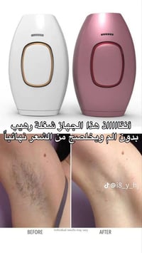 ليزر منزلي • توصيل • عرض خاص