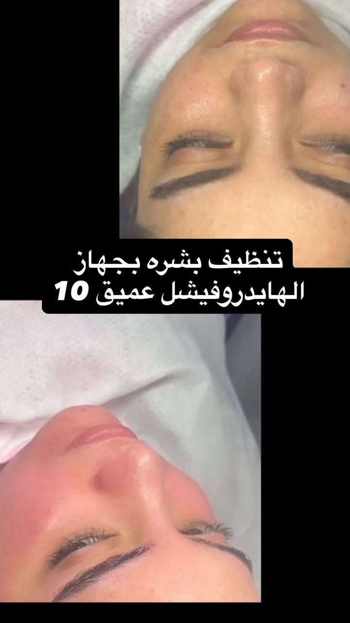 مركز وصالون أسو بيوتي جزء من شغلي العنوان اركيه وفاضل يم أسواق بركات المصطفى مركز وصالون أسو بيوتي متواجدين من الساعه 12 الظهر إلى 11بليل ❣️❣️💅🏻


**إذا كنت صاحب هذا الإعلان وتريد حذفه لأي سبب، رجاءا أرسل رسالة إلى الدعم الفني**
